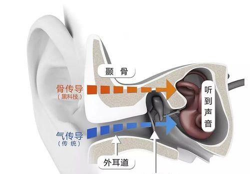 以骨传导耳机对大脑的潜在危害及防范措施（了解骨传导耳机可能对大脑产生的风险）